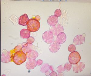Los granos más grandes de tonos anaranjados son de Cistus sp.