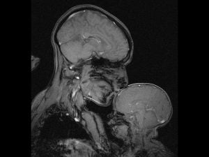 (Rebecca Saxe and Atsushi Takahashi / Department of Brain and Cognitive Sciences, MIT / Athinoula A. Martinos Imaging Center at the McGovern Institute for Brain Research, MIT) Read more: http://www.smithsonianmag.com/science-nature/why--captured-MRI-mother-child-180957207/#M8Pw8YAMqUPRlYTA.99 @SmithsonianMag 